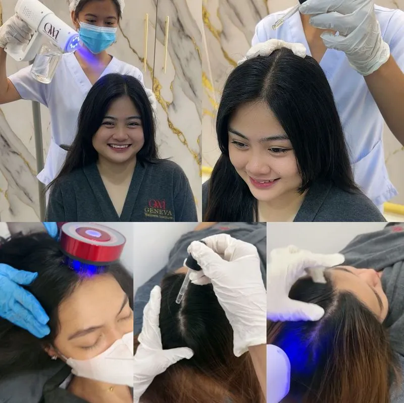 Flaky Scalp Therapy at Geneva Wellness